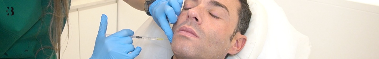 bruxismo como saber si tengo