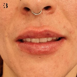 como se hace la hidratacion de los labios