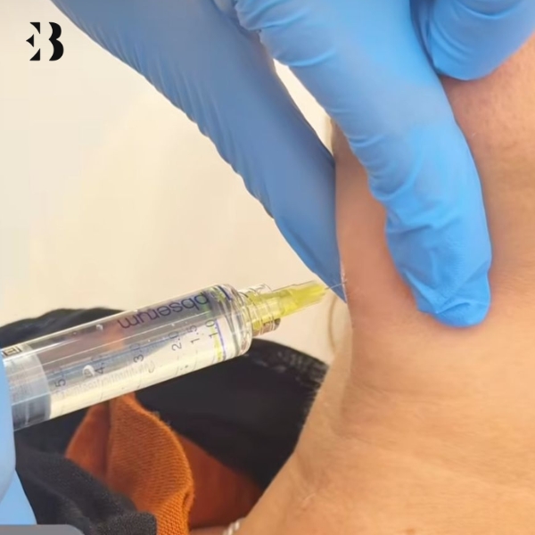 Disminuir Papada sin cirugía- Paciente Clínica EB