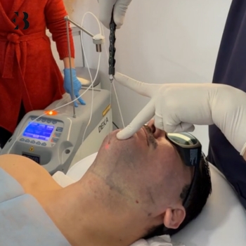 Eliminación de Papada mediante Lipolaser en clínicas EB