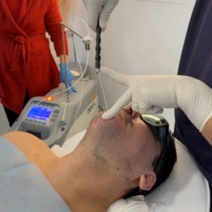 eliminar la papada rapido y facil