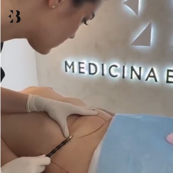 lipolaser precio cuanto vale