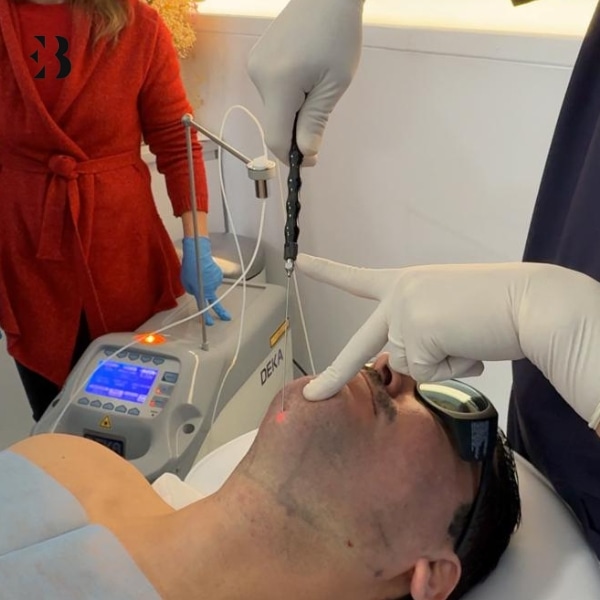 lipolaser precio madrid