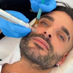 vitaminas faciales antes y despues