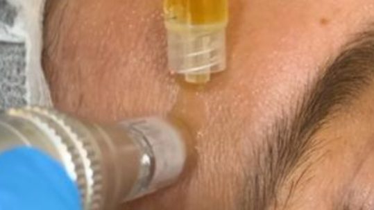 vitaminas faciales cuales son