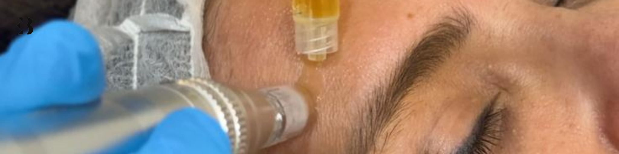 vitaminas faciales cuales son