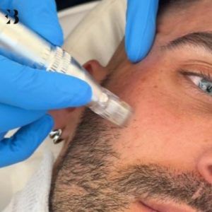 vitaminas faciales rostro