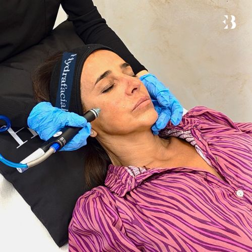 exfoliación hydrafacial. Paciente Carmen Alcayde EB