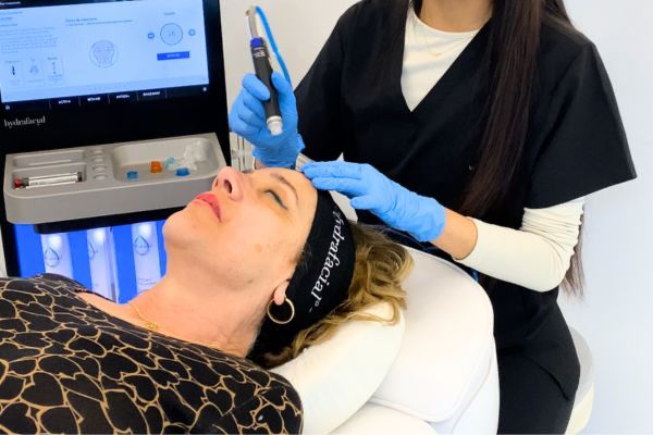 Hydrafacial resultados de limpieza facial profunda