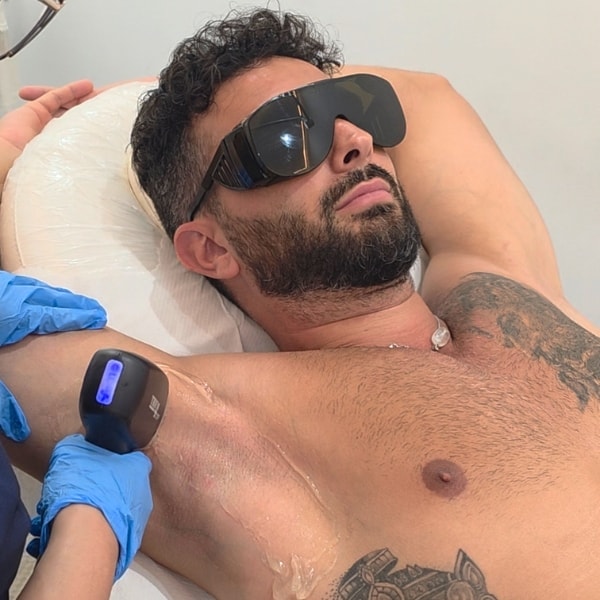 depilación laser axilas en el Centro de Depilación Láser EB