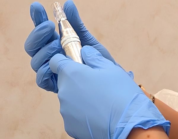 Dermapen con exosomas. Clínica EB en Velázquez Dermapen con exosomas. Clínica EB en Velázquez