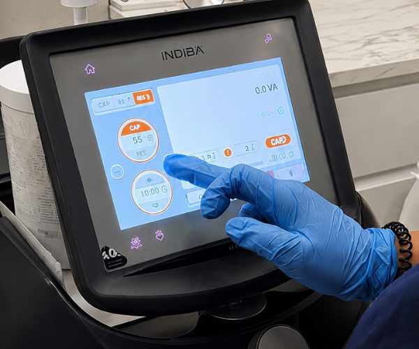 Máquina de Indiba en Clínica EB en Velázquez