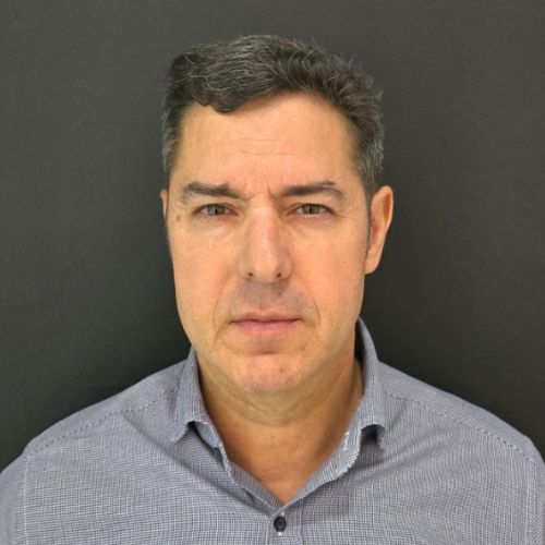El Antes del tratamiento líneas de marioneta en la clínica de medicina estetica EB